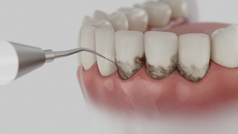 Reliable Emergency Dentist contractor in Plover, WI by Smile Center Dentistry